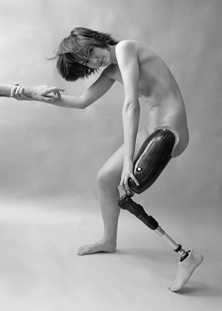 Life On A Prosthesis. by Michael Dorohovich